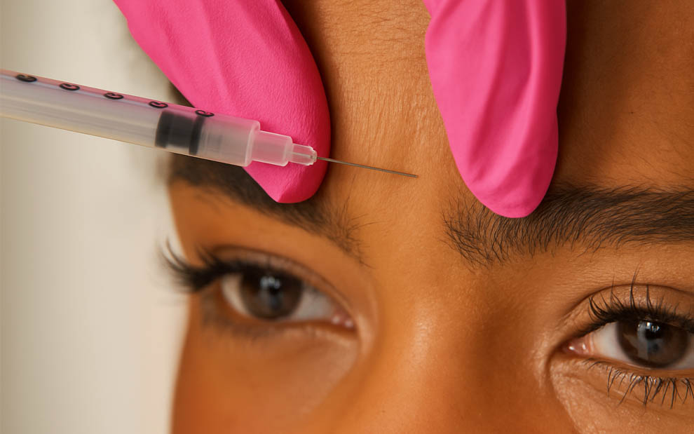 Injections Fillers